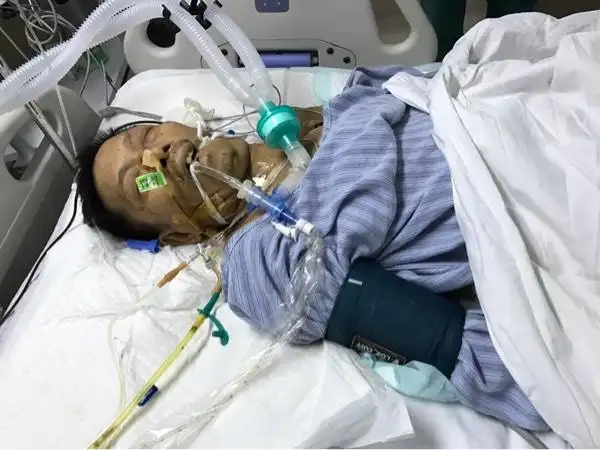 请救救汕大附一重症监护室我的病人生命垂危的黄先生