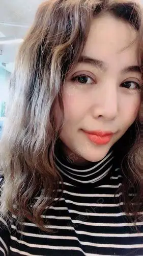 做完双眼皮10天了,日常来打卡,不得不说恢复的真的好.双眼皮_悦美整形