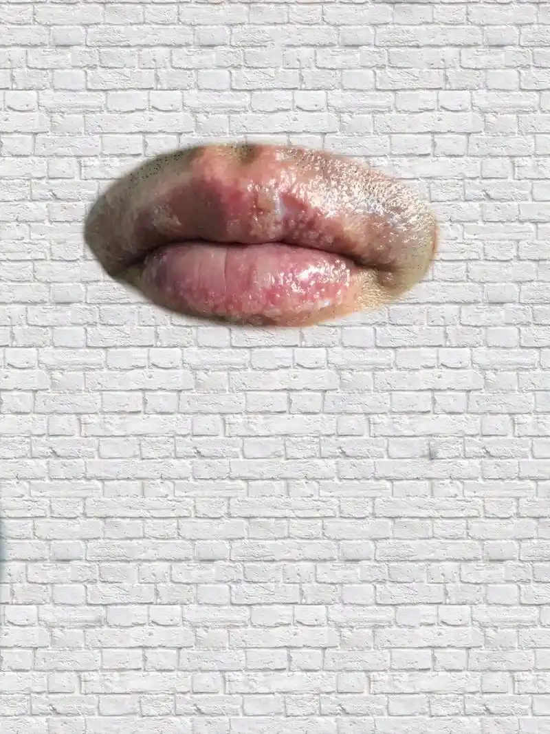 各式各样的"上火""上火"学名单纯疱疹,系由人类单纯疱疹病毒 - 抖音