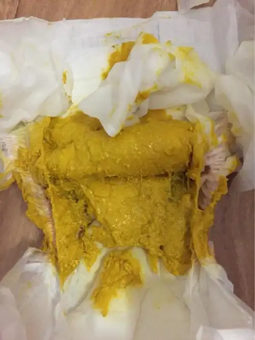 23天的宝宝一天拉一次粑粑,拉的特别多!