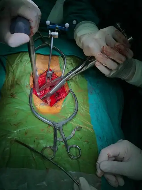 腰椎间盘突出什么时候需要手术? - 好大夫在线