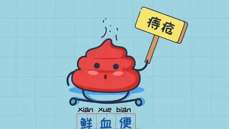 (1)痔疮各期内外痔和混合痔均可引起大便出血,一般为粪便附有鲜血或便