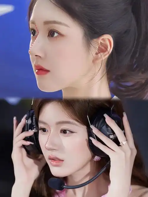 赵露思鼻子都这样了?穿搭时髦却满脸塑料感,高科技真把人给害了