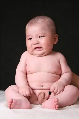 我家孩子出生时右边睾丸一直没有,现在6个半月了还是没有下来.