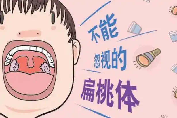 孩子扁桃体肥大久治不愈,该如何治疗?