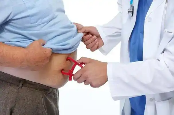 但是,由肥胖引起的肚子大,就完全不是一个性质的东西,游泳圈,啤酒肚