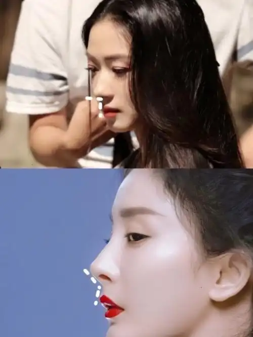杨幂的鼻子为什么总感觉很奇怪