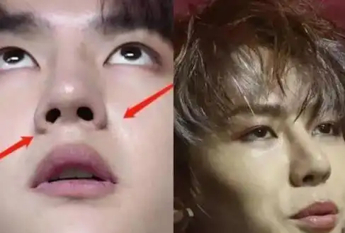 终于有人说实话了知名博主点评王一博整容动过鼻子所以老得快