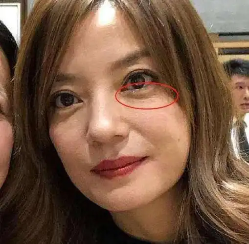 但是眼部的皱纹依然藏不住,眼袋也很明显,看的出来赵薇已经老了很多