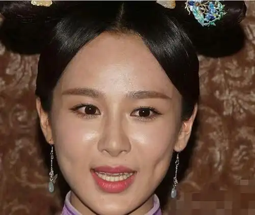 杨紫疑似整容面部僵硬