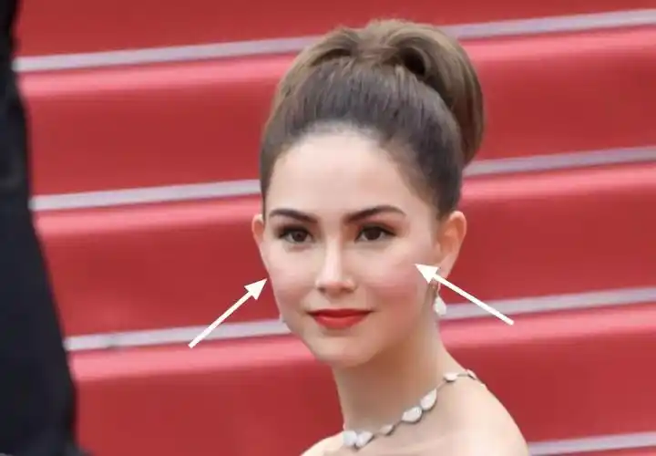 昆凌戛纳被吐槽完全不像25岁其实是脸上这两道沟的锅