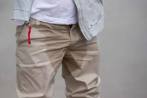 苹果绿 保健常识 遗精的话对于男性朋友来说可能是属于一种较为正常的