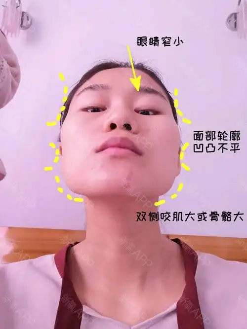 求看脸:头扁国字脸,面塌又凸嘴,能整成鞠婧祎吗?