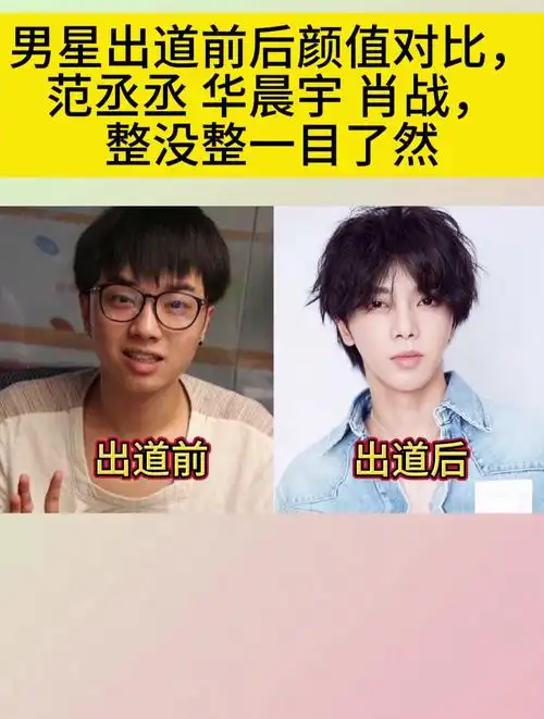 男星出道前后颜值对比范丞丞华晨宇肖战整没整一目了然