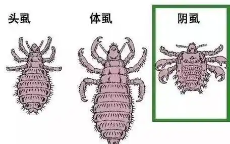 阴虱病有哪些症状什么样子图片如何预防阴虱病