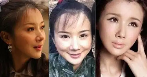 她曾是个天然美女,整容整得不像个人了!