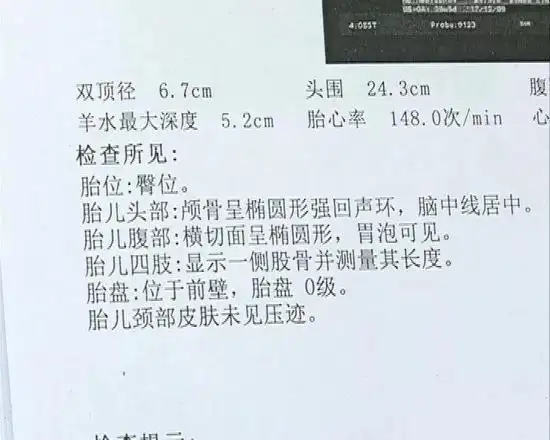 从刘先生提供的检查单可以看到,每次b超都没有提示胎儿有异常.