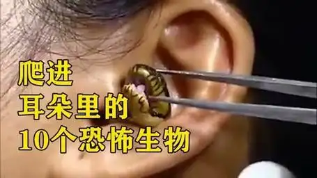 爬进耳朵里的十个奇怪生物,这种虫子让你一秒失去小脑,太可怕了