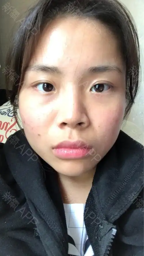 69♀15我的脸型还有得救吗?_圈子-新氧美容整形