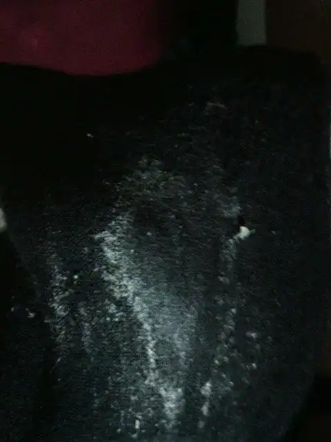 白带这么多正常吗?初潮还没来