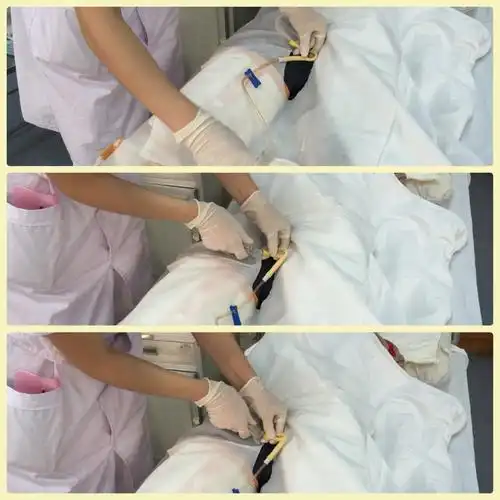 一次性为女病人导尿术操作流程详解图