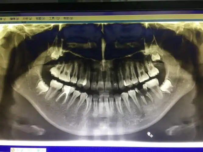 5万患者,其中ct8000余人,dr及牙片15000余人,mri2000余人次  2018年