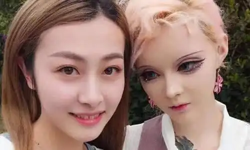 美女为圆梦整容成芭比娃娃,但是现在的样子却让人心疼