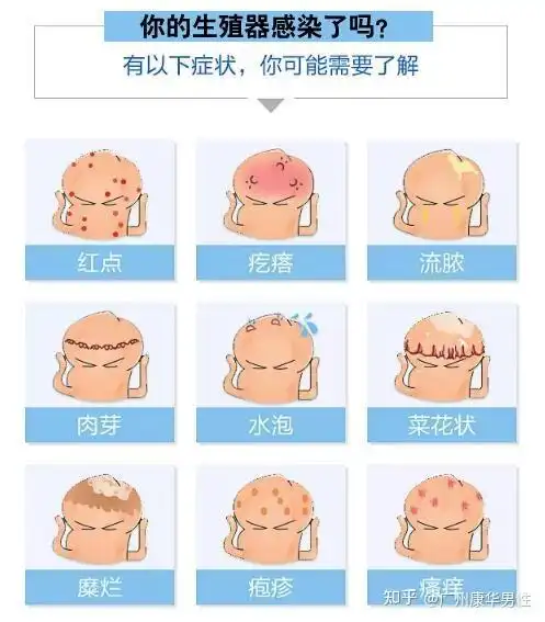 生殖感染症状表现图导致龟头褶皱红斑怎么回事?