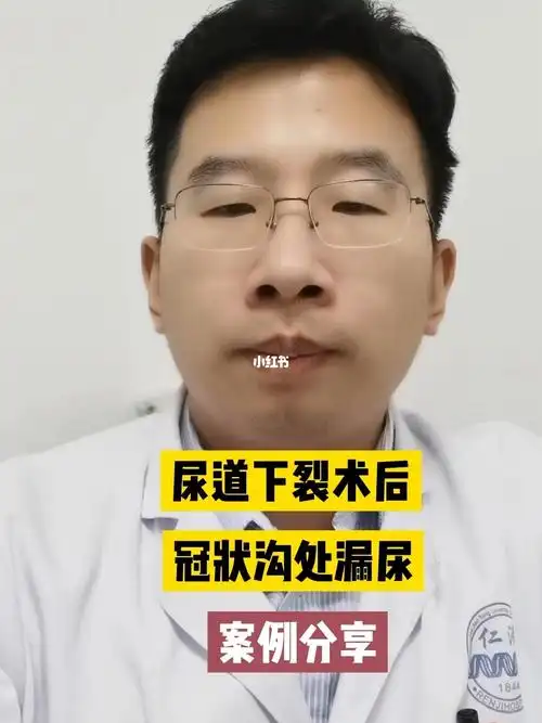 尿道下裂术后冠状沟处漏尿案例分享