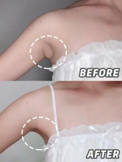 仅七步告别副乳,夏日美起来_腾讯新闻