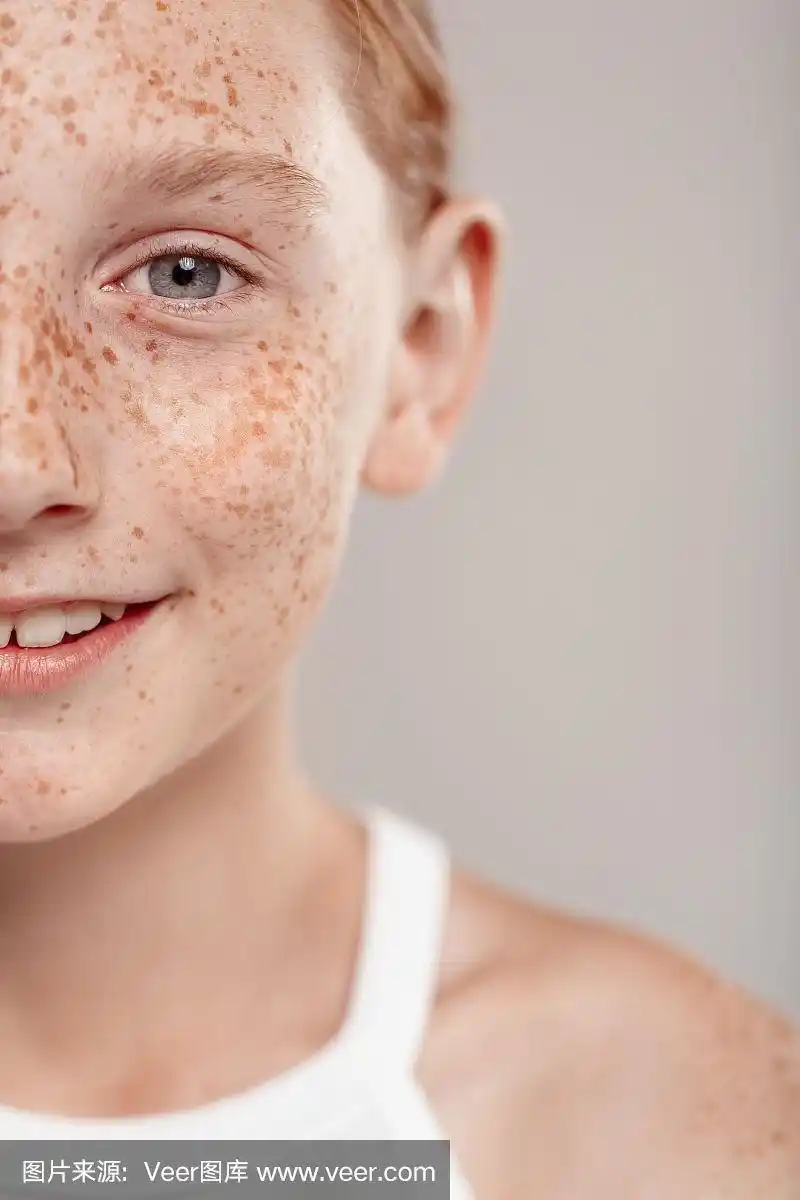 包容的美.满脸雀斑的女孩孤立地站在灰色的半边脸上,近距离微笑着开心