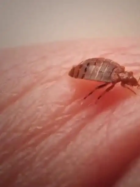 多国爆发床虱危机,已蔓延至亚洲!警惕随行李流动迁徙-度小视