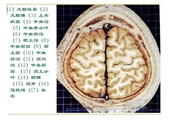所有分类 医药卫生 临床医学 人体断层解剖图谱(大脑)ppt (1)大脑纵裂