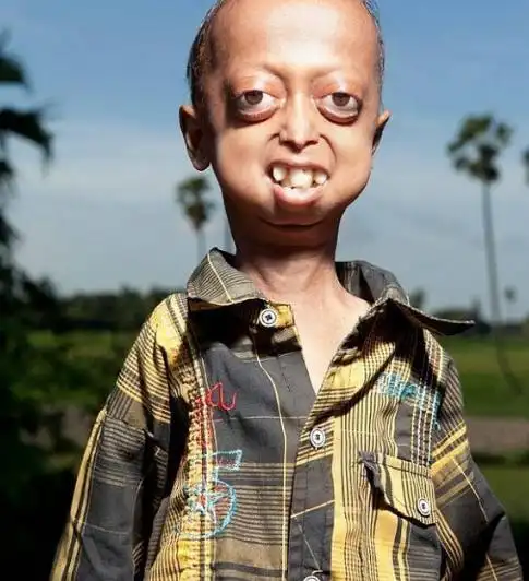 一对夫妇成婚后生下的孩子,个个跟外星人似的,医生大骂:无知