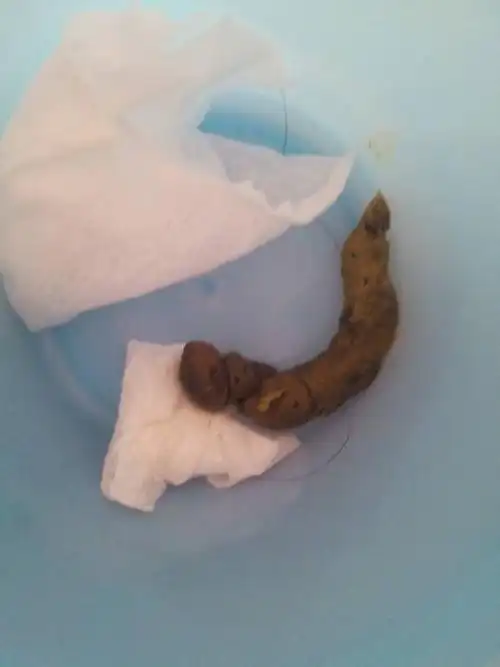 我家宝七个月多月了便秘大便干燥怎么办啊?