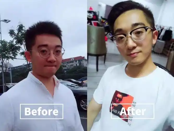 减肥30斤前后脸型变化,堪比换头!