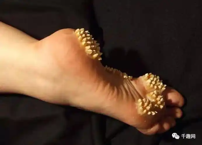 让你鸡皮疙瘩搓不完的疗愈满点密集恐惧症照