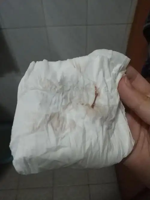 姐妹们这个是排卵期出血吗有图慎点