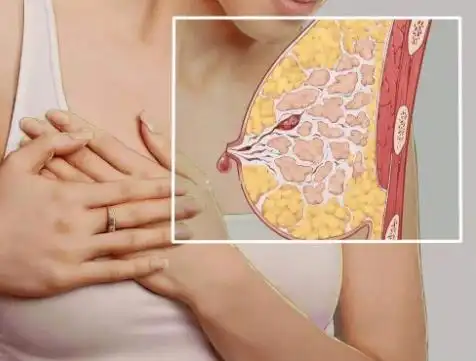 乳腺囊肿不治疗会自愈吗 - 病症知识 - 轻壹