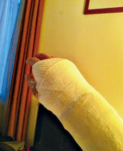 又遇伤病邓华德失去理智 王仕鹏恐将无缘亚锦赛