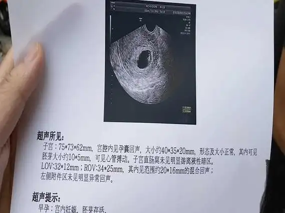 6一7周孕囊大小可看男女,按照公式预测胎儿性别真的准_家庭医生在线