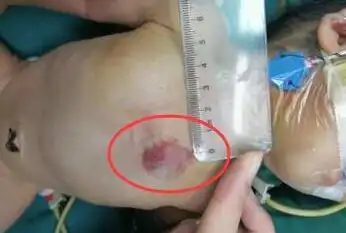 这么多大型社群和媒体都在力挺微播易美拍11日的大直播