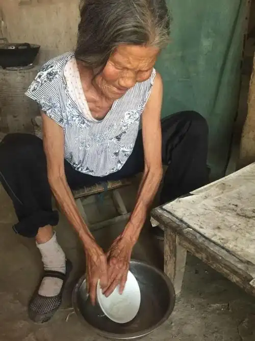几十年来的辛苦劳作,加上吃不饱穿不暖,老人现在瘦的皮包骨,让人