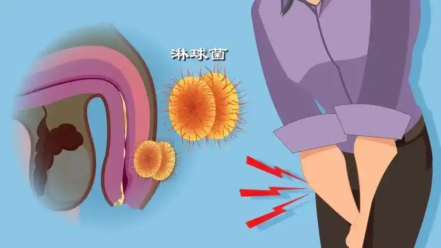 淋病 - 好大夫在线