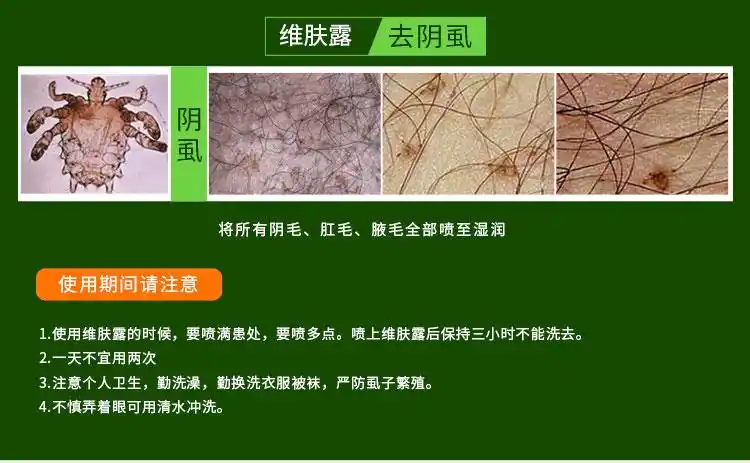亮友灭去头虱子阴虱跳蚤百部酊虱液杀跳蚤维肤露一扫光虱子3件维肤露