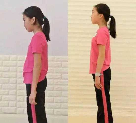 孩子不由自主弯腰驼背耸肩,不止是仪态丑,造成的危害也不小
