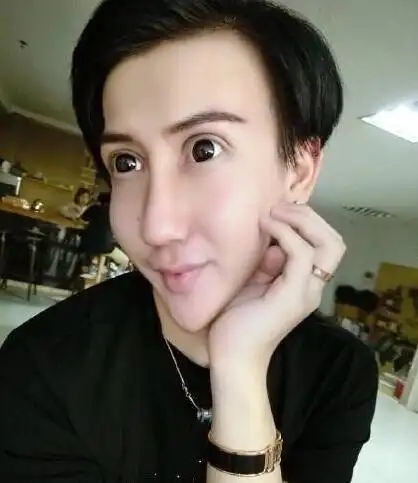 蛇精男靠一张整容脸竟然也进了娱乐圈.