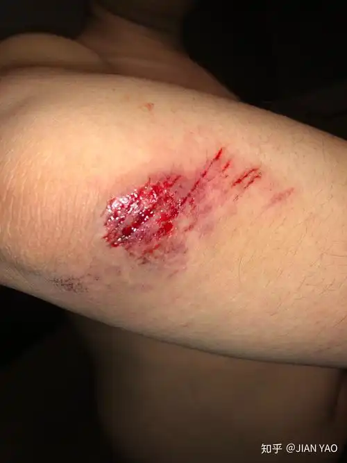 骑行摔车是什么样的体验