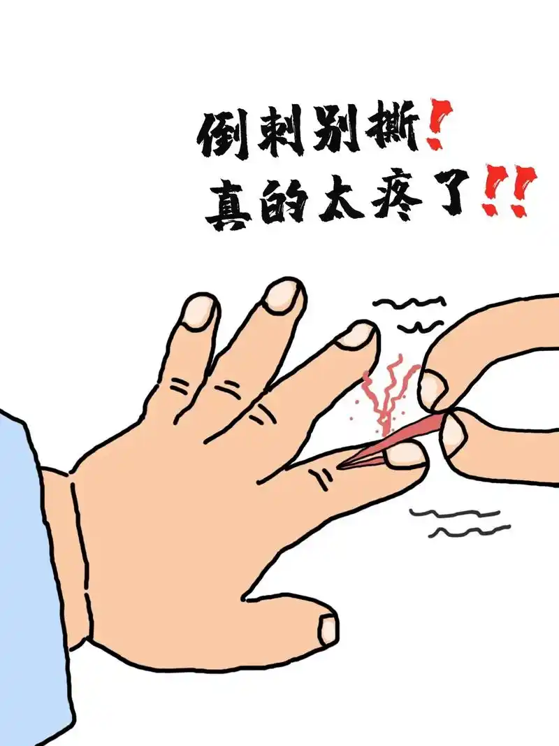 宝宝手上的倒刺又疼又碍事,别担心有它!