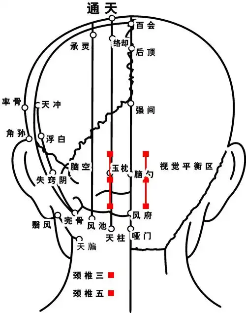 穴位海报印制展板写真喷绘人体脑部头部后脑勺写真
